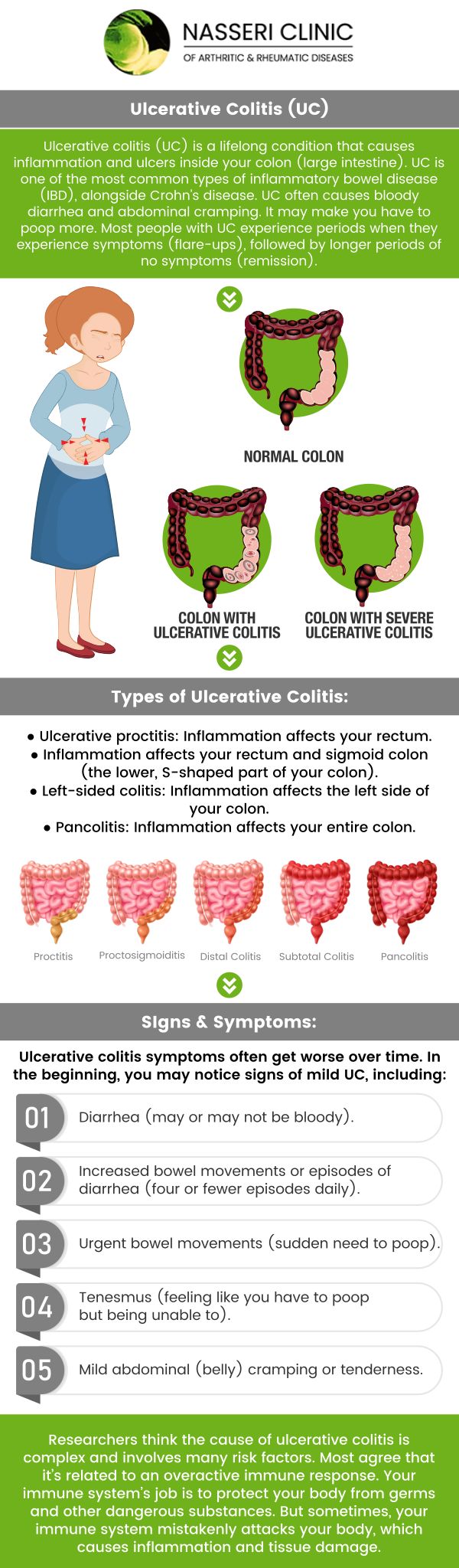 The symptoms of ulcerative colitis (UC) can range from mildly inconvenient to severely disruptive, significantly affecting daily life. Intravenous treatment for UC often involves administering biologic medications or corticosteroids directly into the bloodstream. For professional care, visit Dr. Nasseri, MD, and his team at Nasseri Clinic of Arthritic and Rheumatic Diseases. For more information, contact us or visit us online to book an appointment. We have convenient locations to serve you in Catonsville, Glen Burnie, Columbia, Rosedale, Edgewater, and North Baltimore, MD! The symptoms of ulcerative colitis (UC) can range from mildly inconvenient to severely disruptive, significantly affecting daily life. Intravenous treatment for UC often involves administering biologic medications or corticosteroids directly into the bloodstream. For professional care, visit Dr. Nasseri, MD, and his team at Nasseri Clinic of Arthritic and Rheumatic Diseases. For more information, contact us or visit us online to book an appointment. We have convenient locations to serve you in Catonsville, Glen Burnie, Columbia, Rosedale, Edgewater, and North Baltimore, MD!
