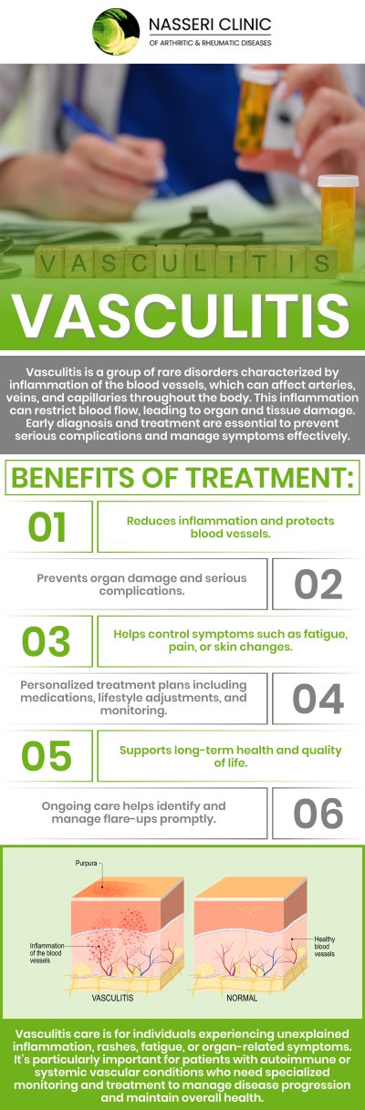 Vasculitis treatment aims to reduce inflammation, manage symptoms, and prevent complications by addressing the underlying cause. Treatment options may include medications, lifestyle adjustments, and supportive therapies. Visit Dr. Nasseri, MD, and his experienced team to explore personalized care for effective vasculitis management. For more information, contact us or request an appointment online. We serve patients from Catonsville MD, Glen Burnie MD, Columbia MD, North Baltimore MD, Rosedale MD, Edgewater MD.