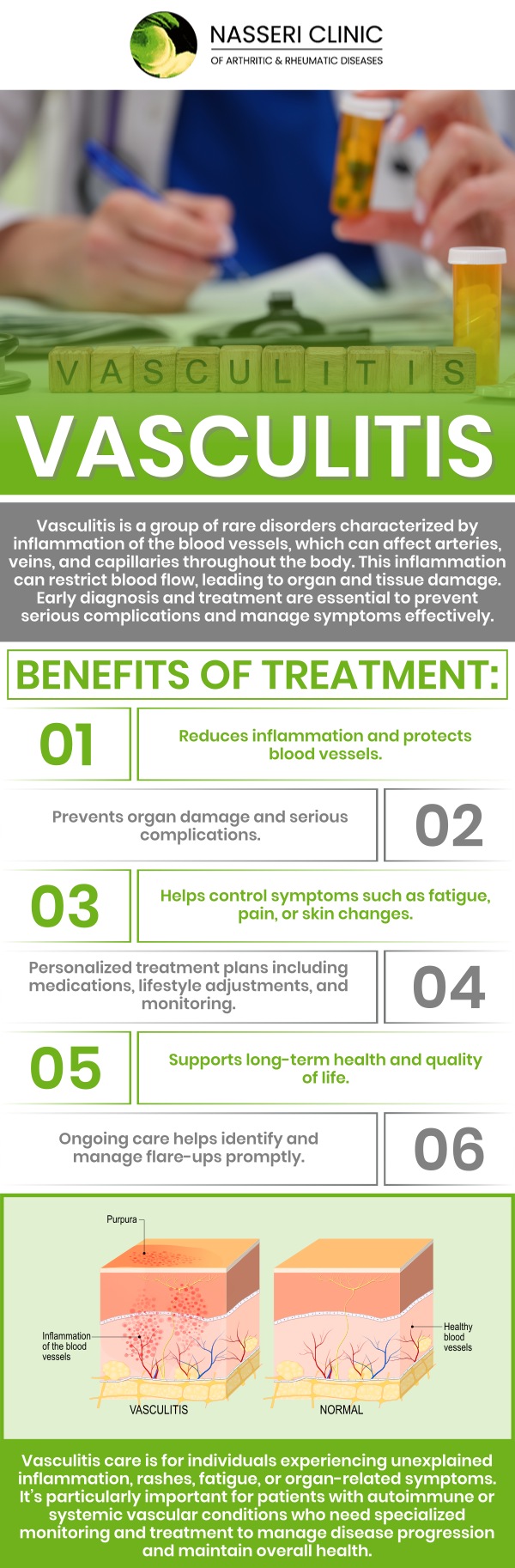Vasculitis treatment aims to reduce inflammation, manage symptoms, and prevent complications by addressing the underlying cause. Treatment options may include medications, lifestyle adjustments, and supportive therapies. Visit Dr. Nasseri, MD, and his experienced team to explore personalized care for effective vasculitis management. For more information, contact us or request an appointment online. We serve patients from Catonsville MD, Glen Burnie MD, Columbia MD, North Baltimore MD, Rosedale MD, Edgewater MD.